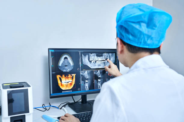 Best Emergency Wisdom Teeth Removal in Pinewood, FL