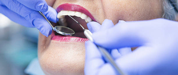 Best Emergency Tooth Extraction in Pinewood, FL